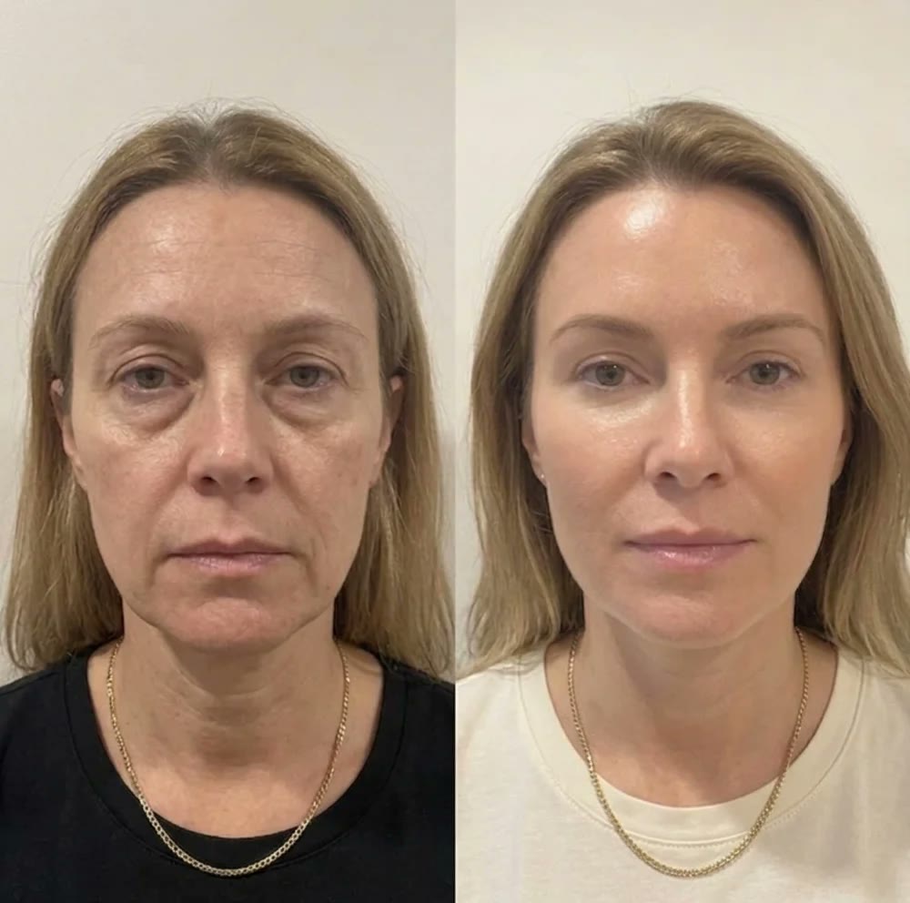 Kundebillede af Lovelle Glow
